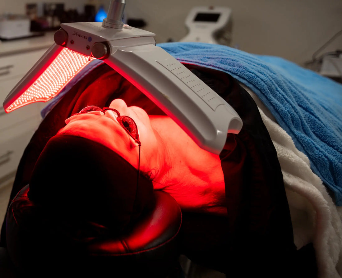 Skin Needling in St George QLD: Complete Beginner’s Guide